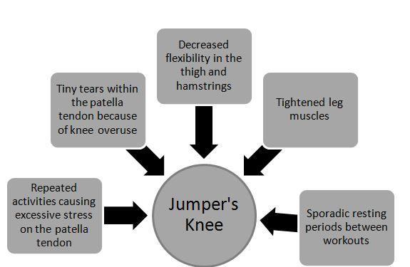 Jumpers Knee The Symptoms And Treatment Hpfy